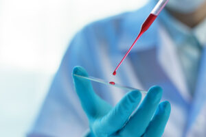 Minicurso de hemograma e marcadores tumorais em oncologia